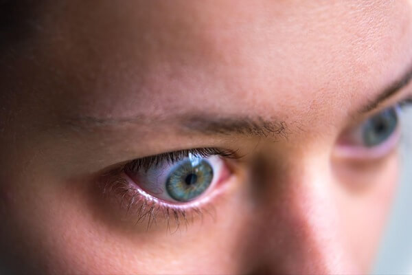 Wide eye