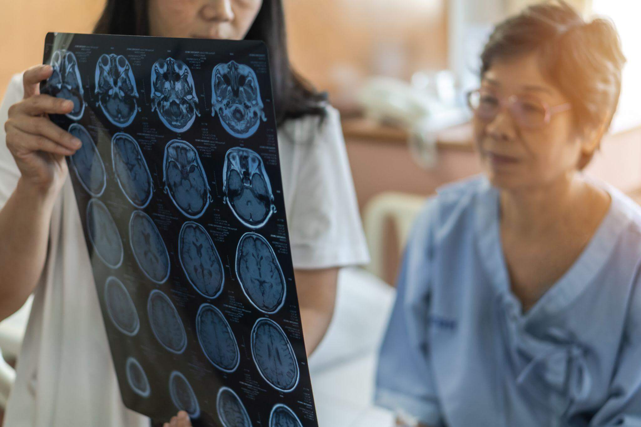 Doctor showing x-ray to a patient